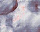 spiegelung in der geometrie anatomische lehrmittel